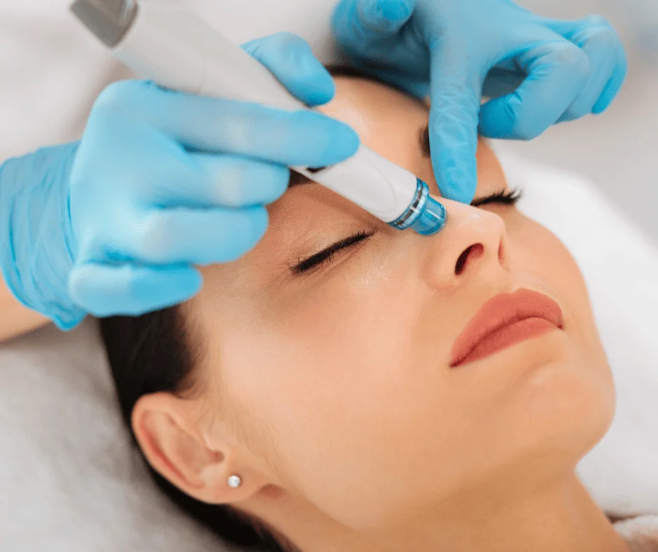 Limpieza Hydrafacial extracción de comedones