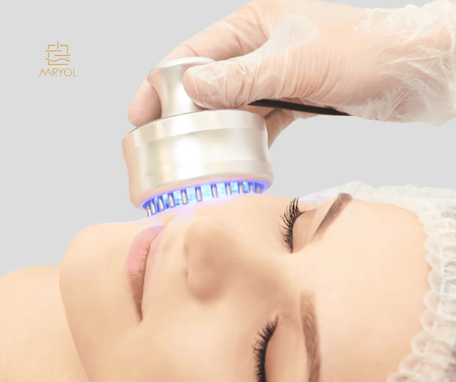 Ventajas de la Radiofrecuencia Facial