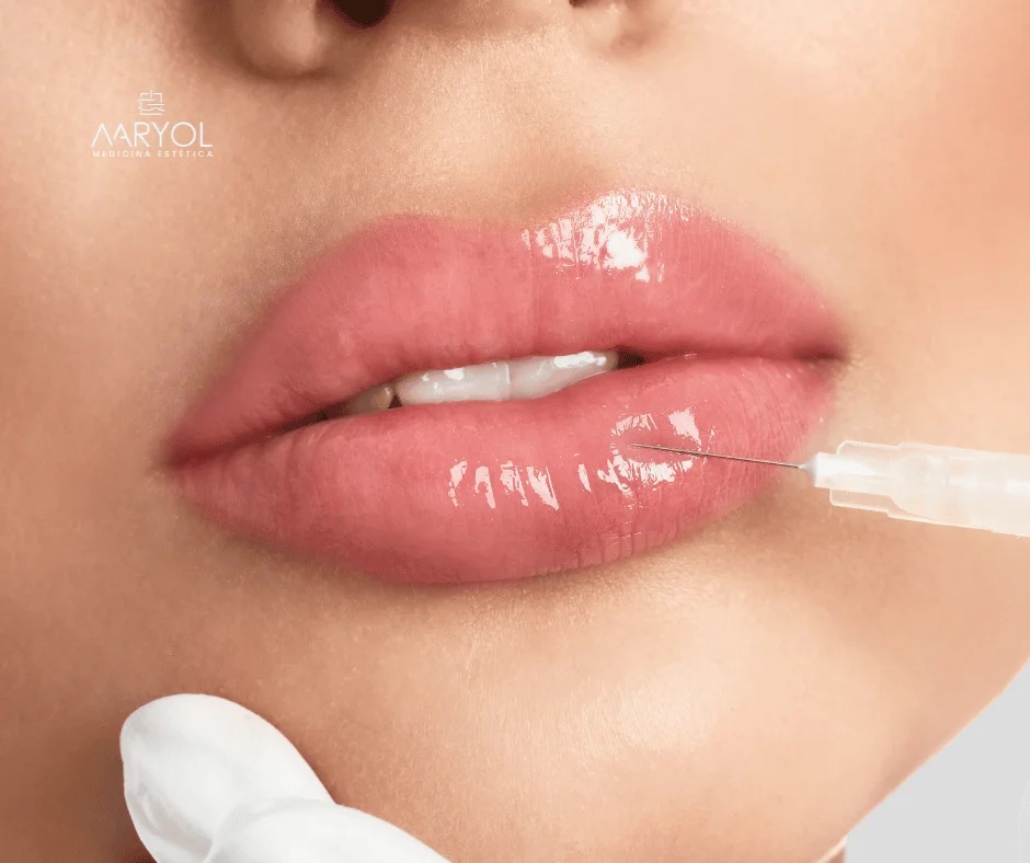 Relleno de Labios: Todo lo que Necesitas Saber para un Aumento Natural y Atractivo