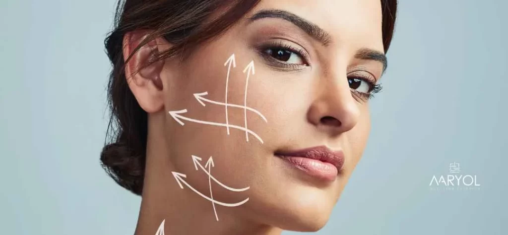 Hilos tensores en Lima