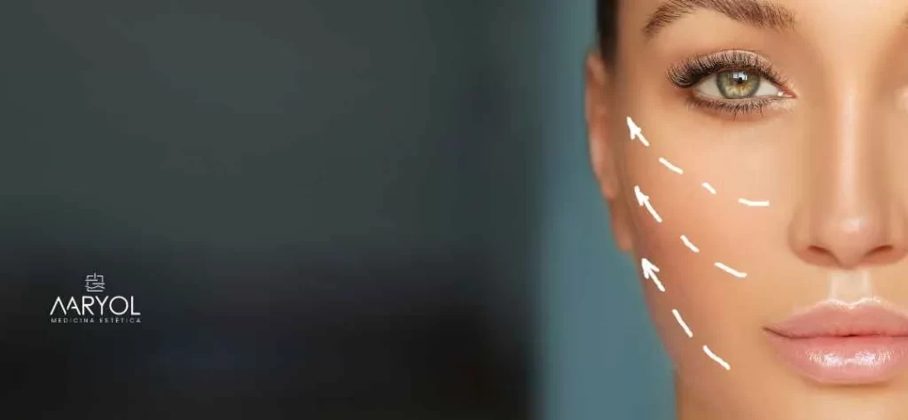 Resultados de los hilos tensores