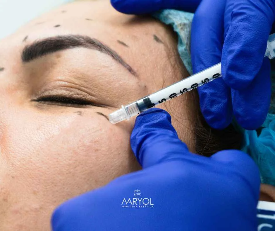 Toxina botulina full face