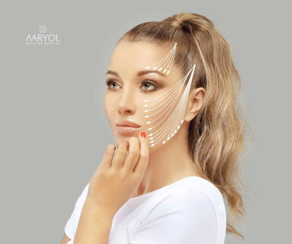 Hilos tensores para rejuvenecer la piel