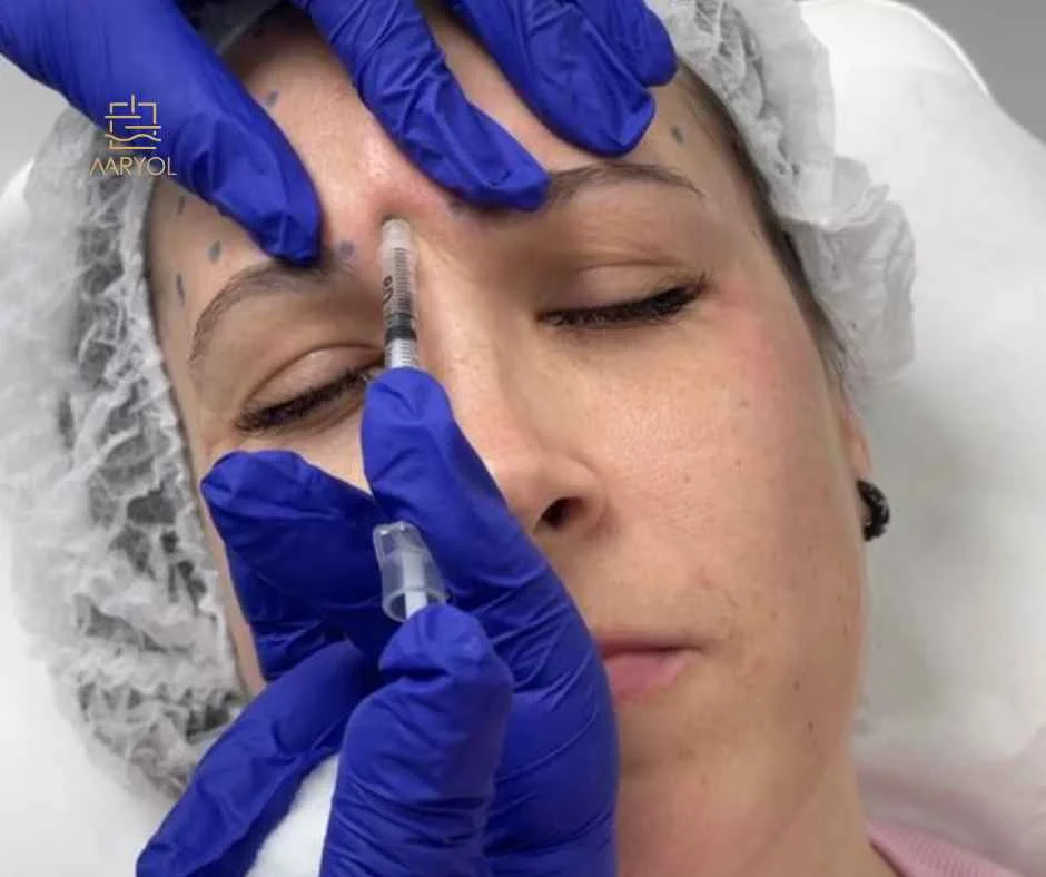 Beneficios de la toxina botulínica