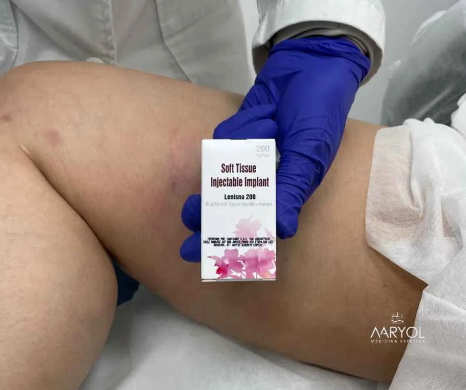 Reducción de celulitis con Bioestimulador Lenisna