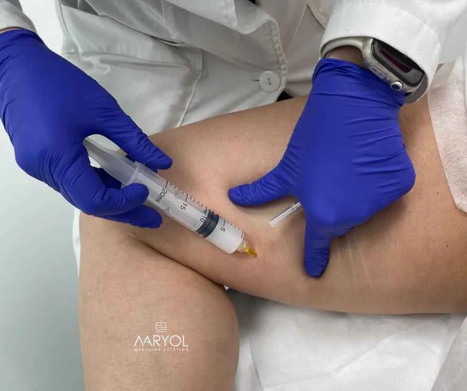 Reducción de celulitis con Bioestimulador Lenisna