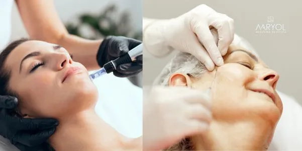 Skinboosters vs. bioestimuladores: ¿cuál es mejor según tu tipo de piel?