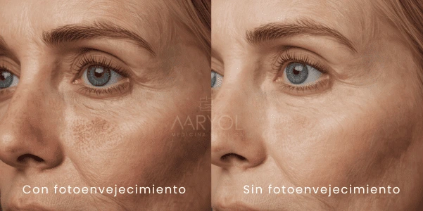 Tratamientos para el fotoenvejecimiento del rostro