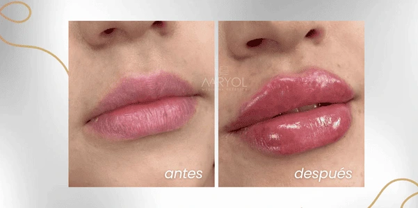 Proyección de labios